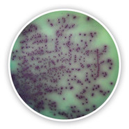 Pseudomonas chromogenic Agar