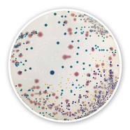 UTI chromogener Agar