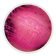 Bengal Red Agar (with chloroamphenicol)