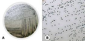 Baird Parker, agar (base)