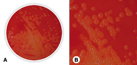 Blood Agar (Base)