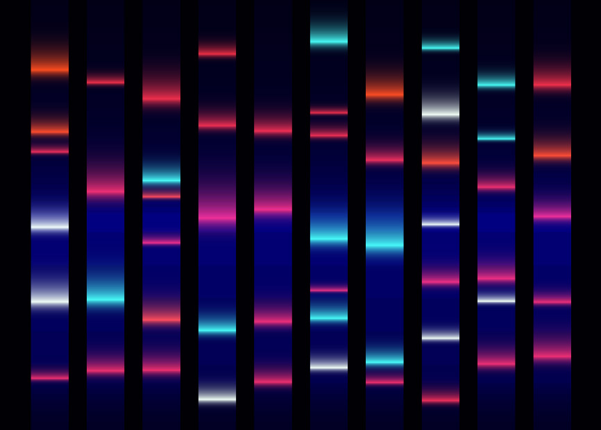 Elektrophorese_2022.jpg Elektrophorese_2022.jpg